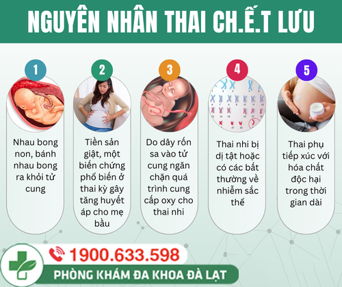 Hình ảnh minh họa